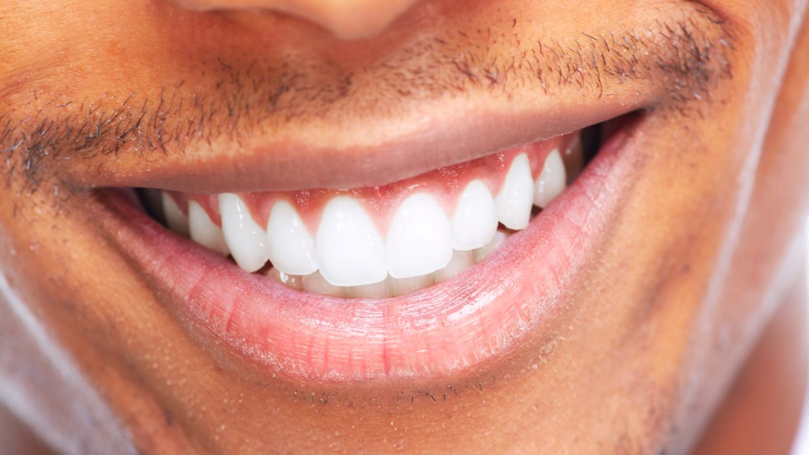 Zeramex Dentalpoint Zähne Zahnimplantate Keramikimplantate